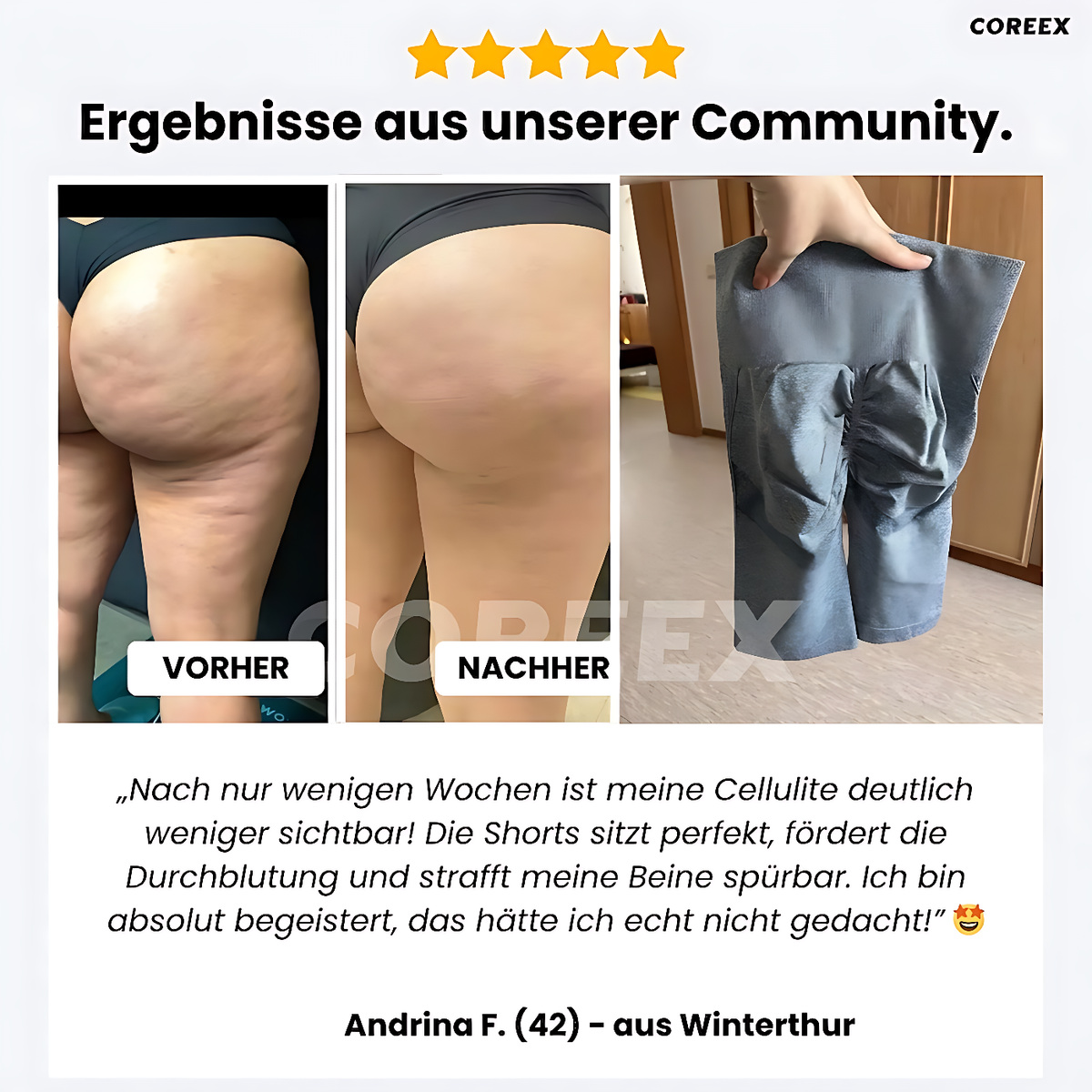 COREEX CelluFlex™ 3D-Kompressionsshorts
