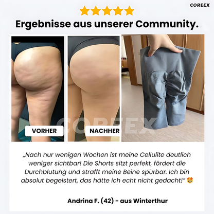 COREEX CelluFlex™ 3D-Kompressionsshorts