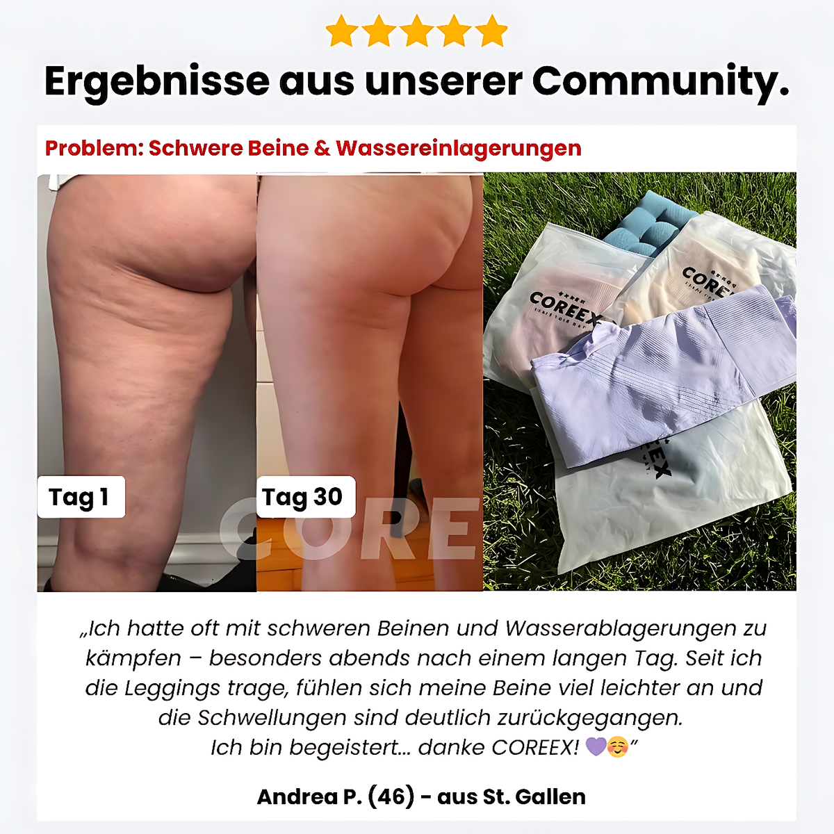 COREEX CelluFlex™ 3D-Kompressionsleggings LIMITED EDITION