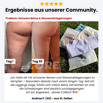 COREEX CelluFlex™ 3D-Kompressionsleggings LIMITED EDITION