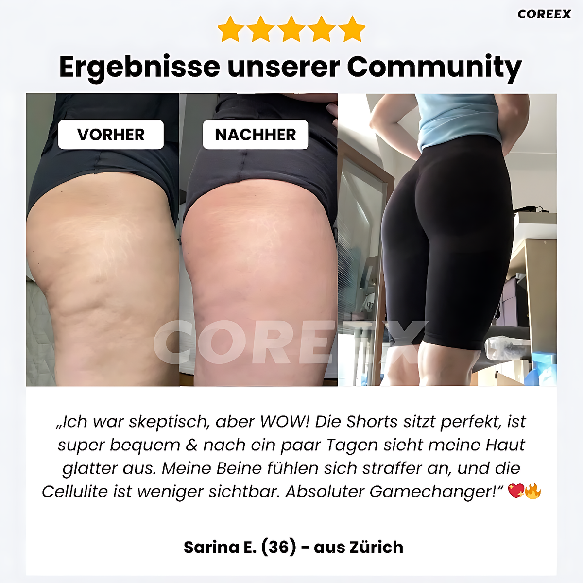 COREEX CelluFlex™ 3D-Kompressionsshorts